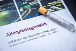 Medizinische Ausrüstung für Allergiediagnostik