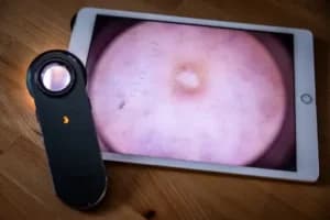 Medizinische Ausrüstung zur Durchführung eines Hautcheck