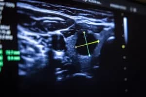 Abbildung eines sonografischen Scans